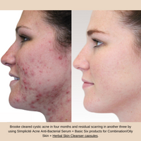 Herbal Skin Cleanser Capsules (IN STOCK for email/phone orders only)
