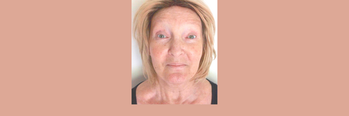 How to banish dry skin during chemotherapy treatment